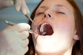 prophylaxis prophylaxis