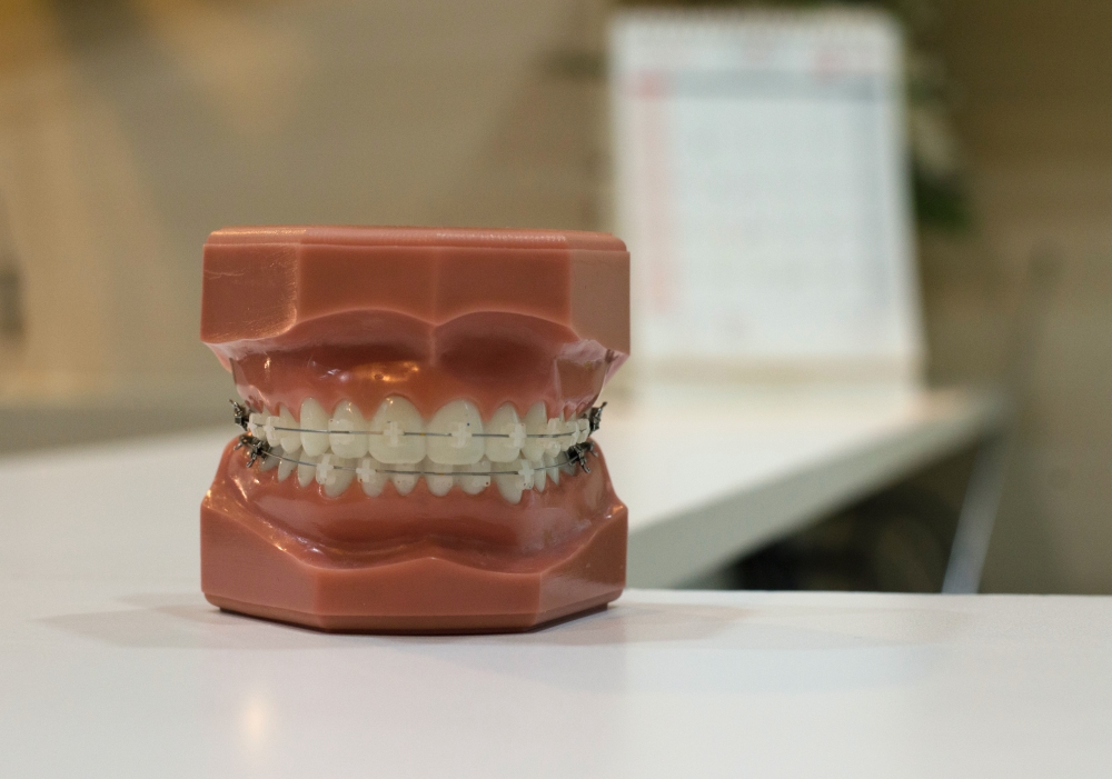 braces or Invisalign