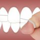 why you should floss every day