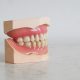 Teeth Stains