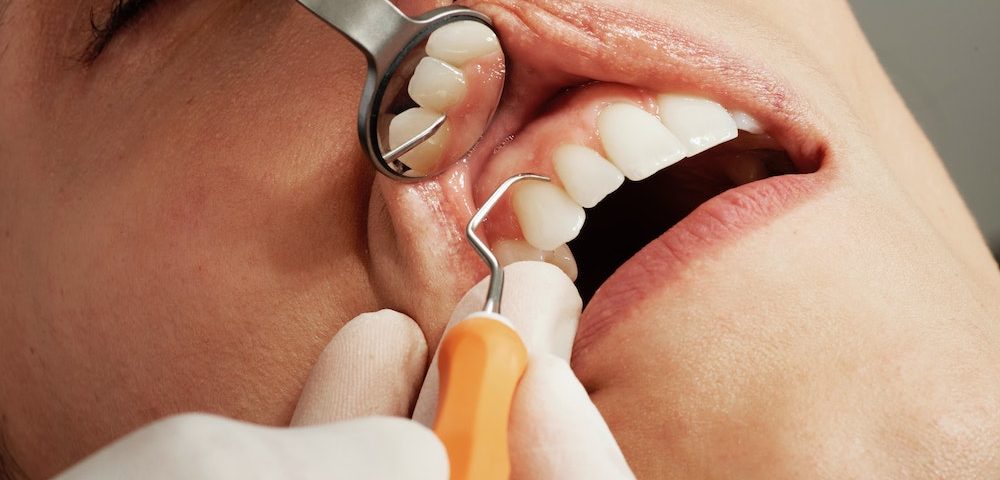 Gum Disease Causes and Symptoms