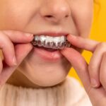 How Long Does Invisalign Take to Work