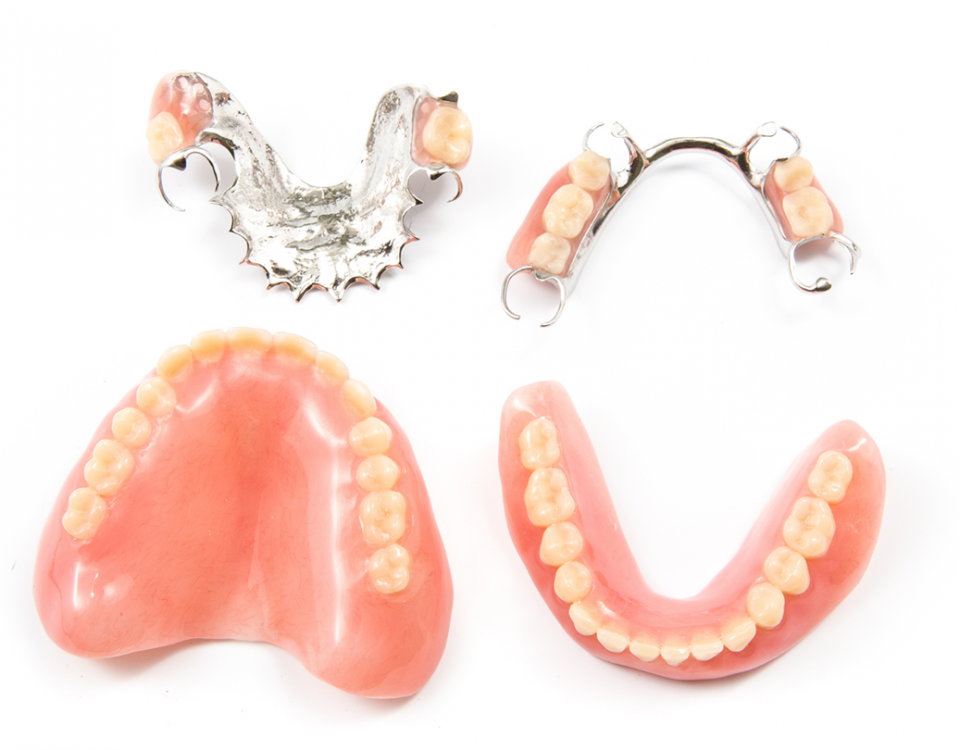 what are the different types of dentures