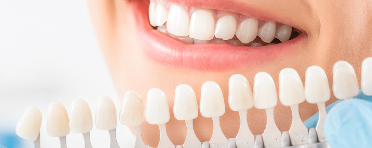 is teeth whitening safe