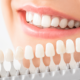 is teeth whitening safe