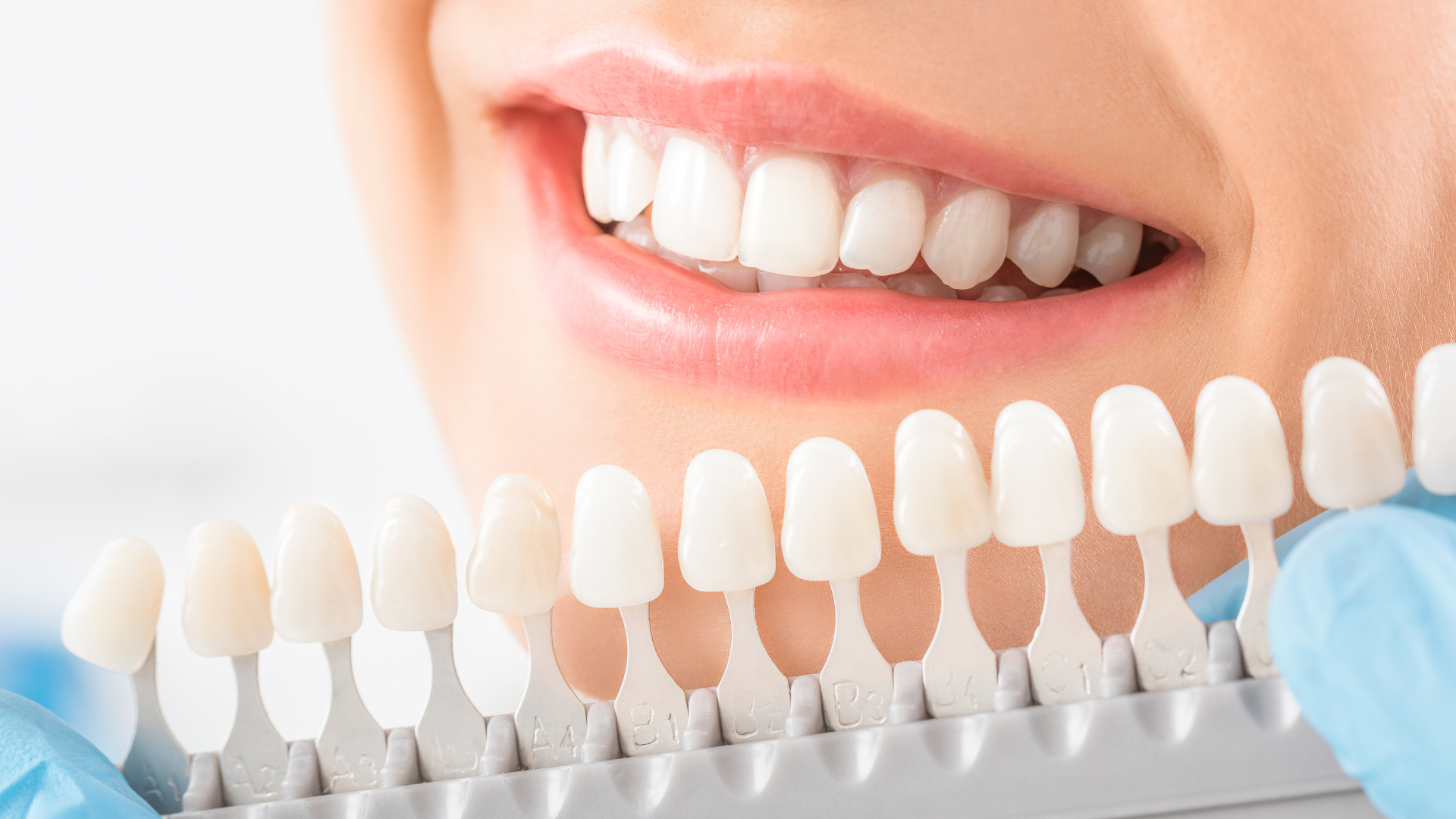 is teeth whitening safe