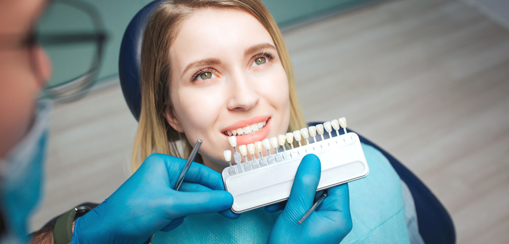 what are dental veneers