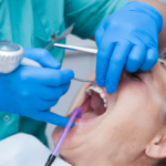 how to treat gingivitis