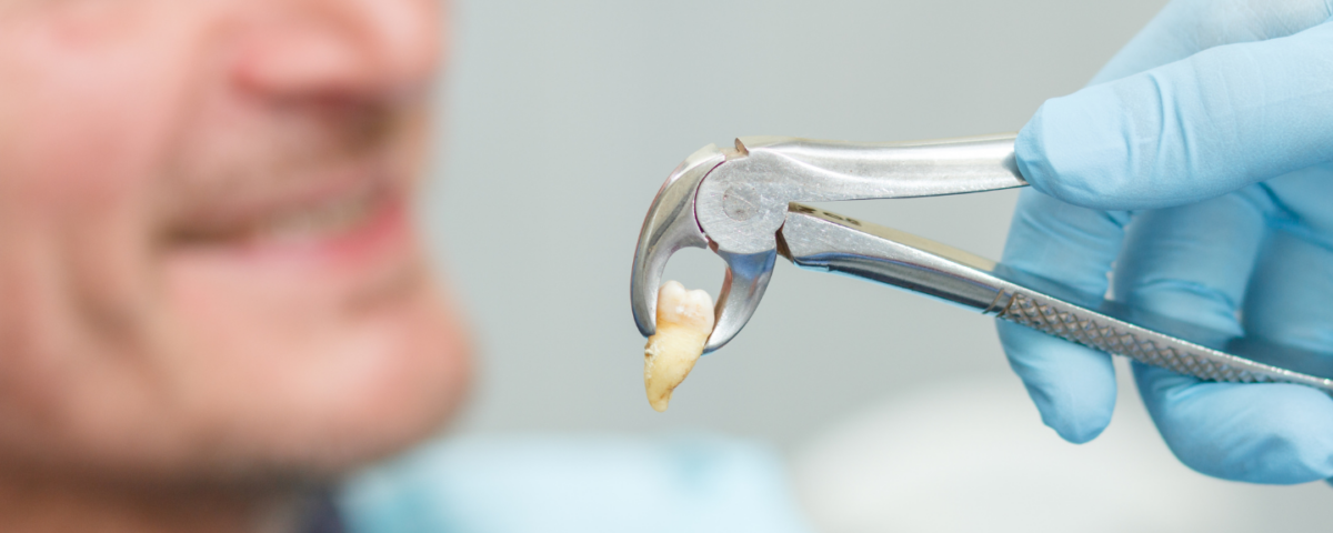 what can I eat after tooth extraction