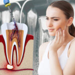 signs you need a root canal